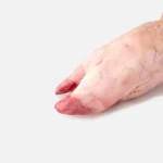 mano cerdo